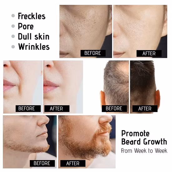 Rullo Derma nero opaco 540 con etichetta privata di vendita calda con micro ago opaco